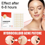 Patchs hydrocolloïdes anti-imperfections 144 pièces