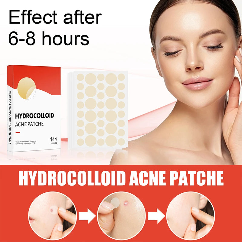 Patchs hydrocolloïdes anti-imperfections 144 pièces