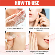Patchs hydrocolloïdes anti-imperfections 144 pièces