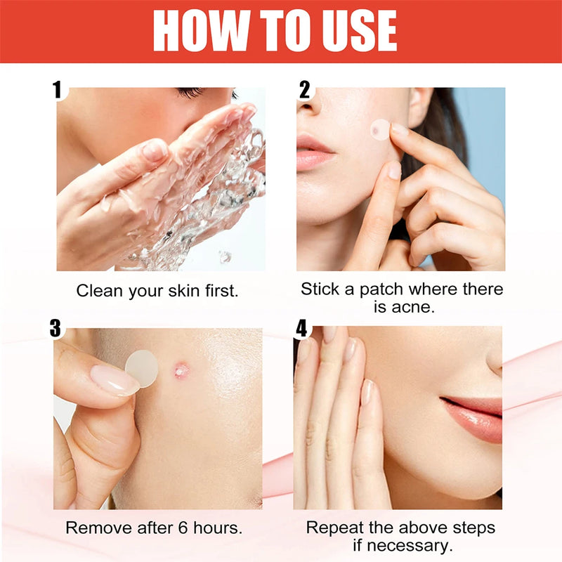 Patchs hydrocolloïdes anti-imperfections 144 pièces